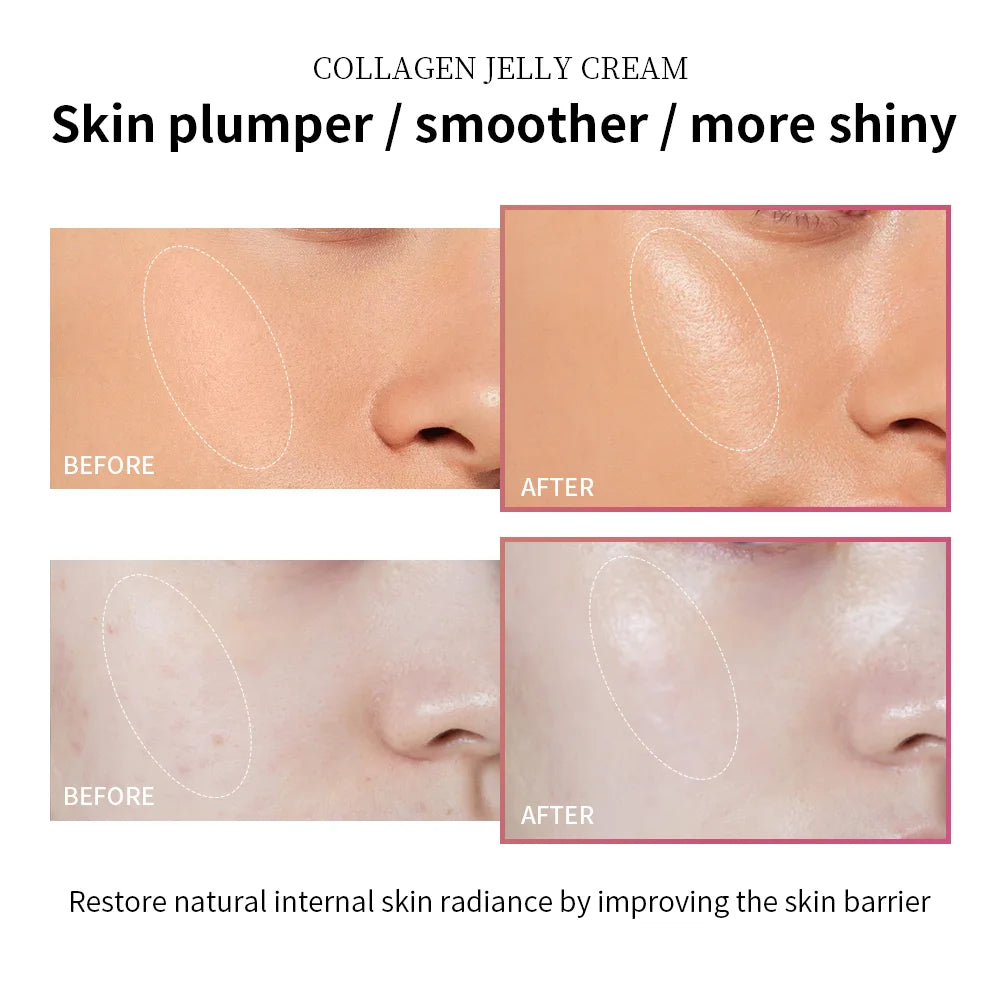 100ml Collagen Jelly Cream Niacinamide Tightening Soothing Moisturizing Anti-Aging Firmness Hydration Skincare 100ml Face Gel Comfort Life